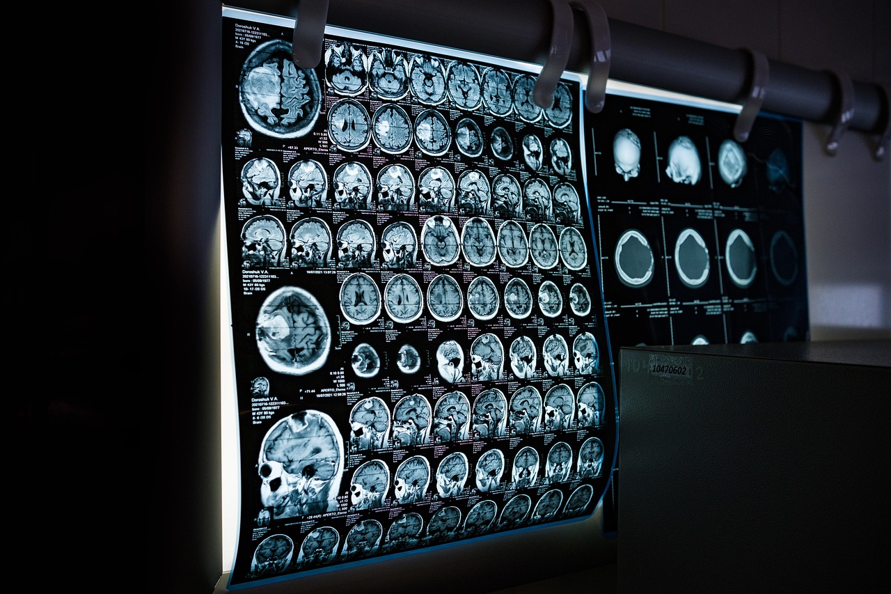 The Scan's Secret Whisper: AI Uncovers Hidden Illness